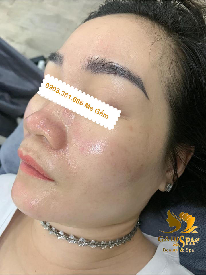 Nếu bạn đang tìm kiếm dịch vụ hỗ trợ điều trị tàn nhàng, đồi mồi tận gốc thì Spa chuyên trị nám Quận 12 sẽ là sự lựa chọn tốt nhất dành cho bạn.