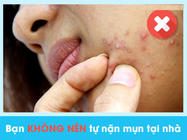 Spa trị mụn quận 12 tphcm - Để có thể làm mờ hoàn toàn những nốt mụn xấu xí trên da, phái đẹp đã lựa chọn dịch vụ lấy nhân mụn tại những thẩm mỹ viện uy tín.