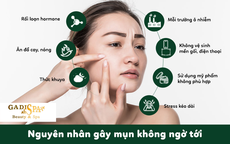 Spa lấy nhân mụn chuẩn y khoa quận 12 - Gadi spa - Để có thể quyết định nặn mụn ở spa hay tại nhà thì bạn cần biết nguyên nhân tại sao mình nổi mụn, hiểu đúng tình trạng mụn